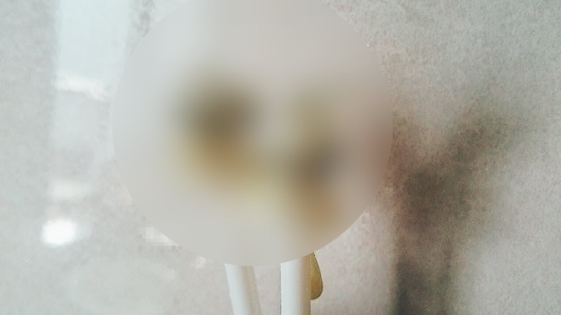 鼻毛脱毛は脱毛クリニックが正解！セルフ鼻毛脱毛の方法5選とメリット・デメリット、脱毛クリニックで鼻毛を脱毛するメリットについて解説